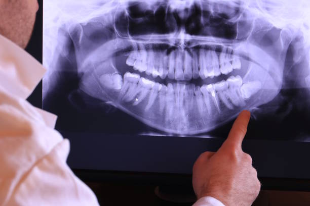 Best Emergency Dental Care for Sports Injuries in Lake Lakengren, OH